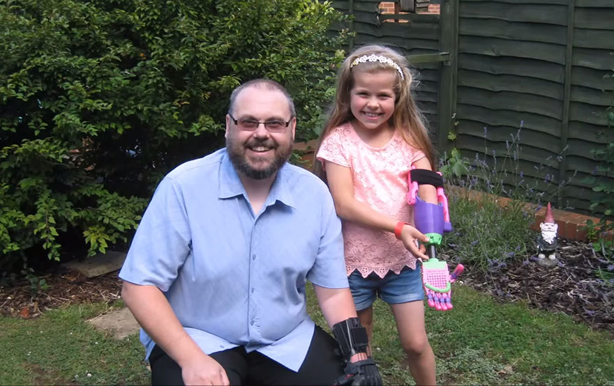 3d-printed-prosthetic-arm-stephen-davies-enable-isabella-5-028